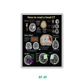 HEAD CT